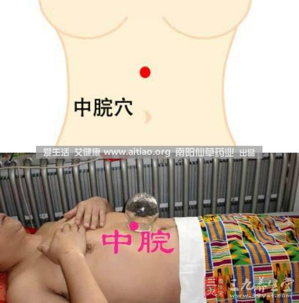 中脘穴位于腹部正中線，臍上4寸的位置上。每天艾灸10-15分鐘，能有效緩解胃部不適的癥狀，同時(shí)有助于祛濕。