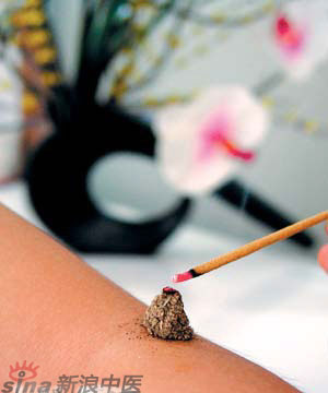 節(jié)氣灸” 冬至，你灸了嗎？